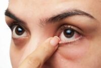 Foto Ilustrasi. (int)