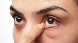 Foto Ilustrasi. (int)