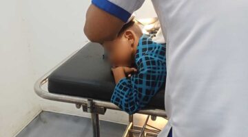 Diduga Salah Sasaran, Bocah di Bone Dianiaya Pria Dewasa hingga Luka di Kepala. (ist)